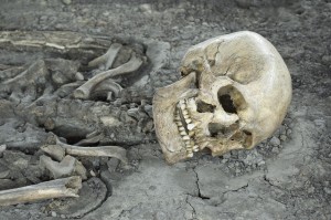Was it a painless post mortem?